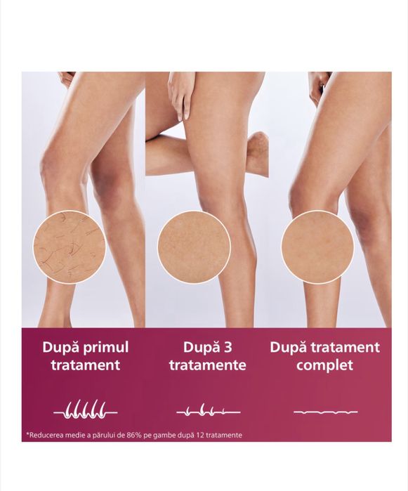 Фотоепилатор IPL Philips Lumea Series 9900 BRI973/00