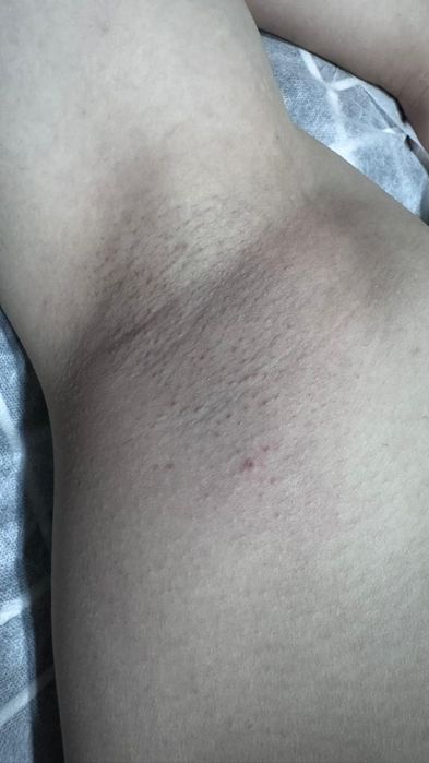 Шугаринг для мужчин