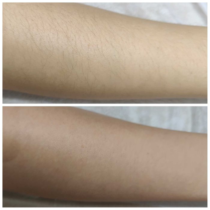 Epilare pentru bărbați, Epilare pentru femei,Epilare cu zahăr si ceară