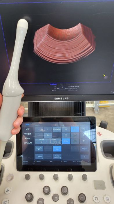 УЗИ аппарат Samsung Medison HS60