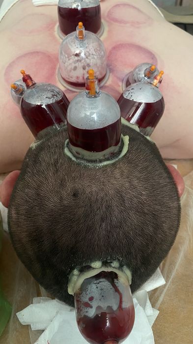 Массаж лечебно оздоровительный