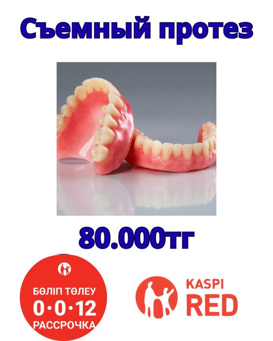 Протез Алматы Стоматология Алматы Стоматолог Акция Винир Брекет Починк