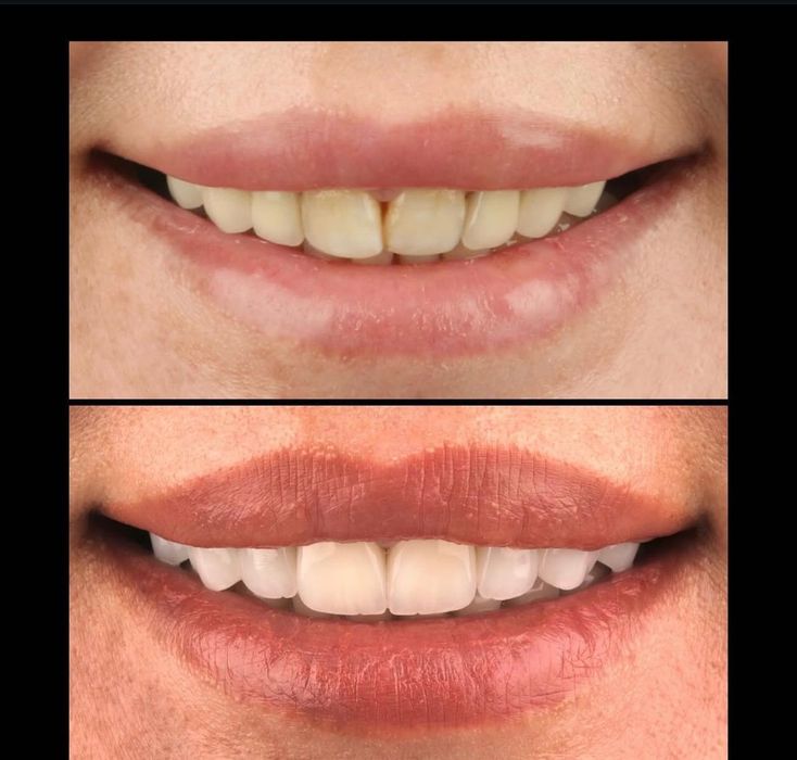 Canon 650D Sigma 105mm SoftBox Godox 400sk