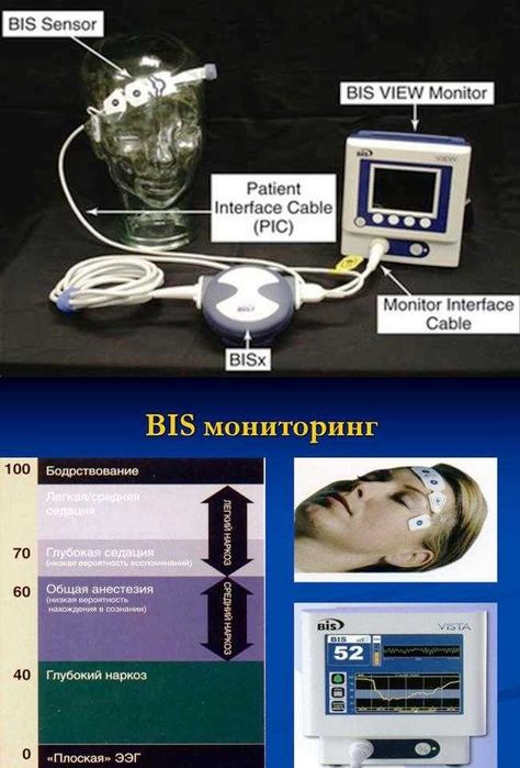Монитор пациента. Aspect BIS Vista.