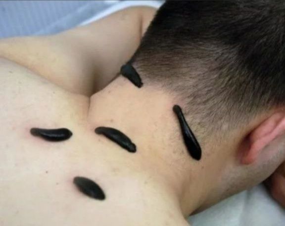 Тиббий ЗУЛУК ОПТОМ нархда