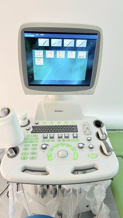 Узи аппарат sonoscape