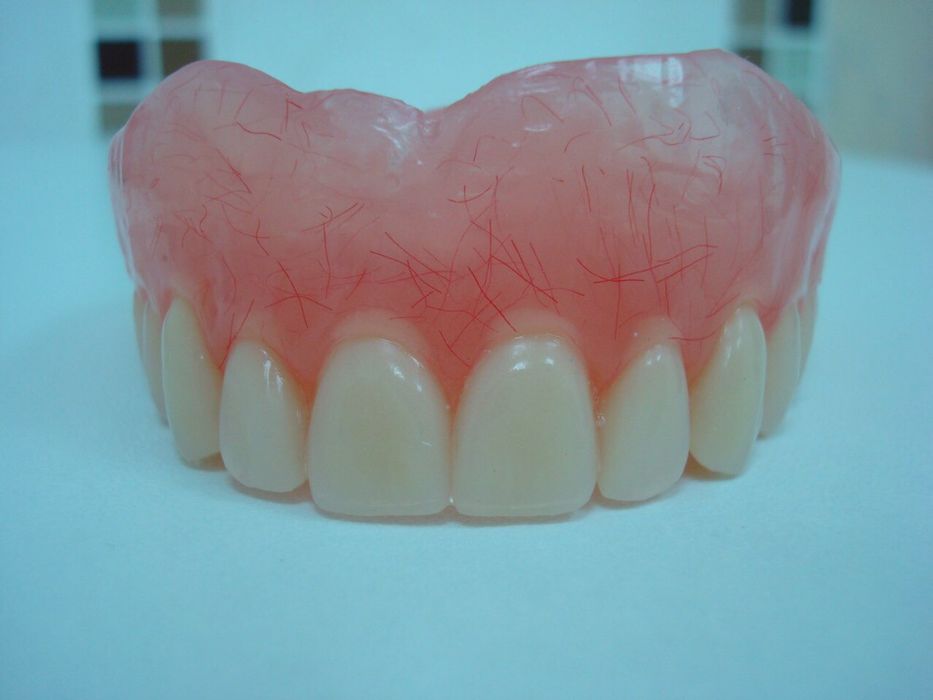 Сьемные зубные протезы