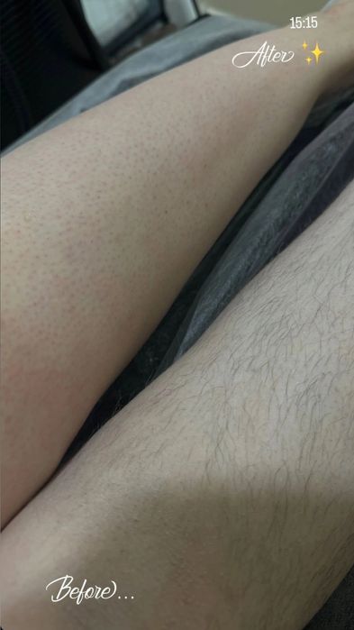 Шугаринг всего тела.