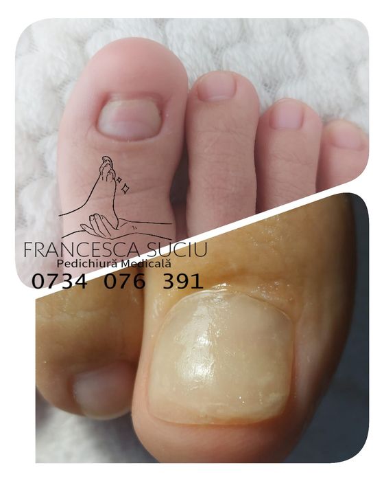 Pedichiura medicala și manichiura(acreditat)