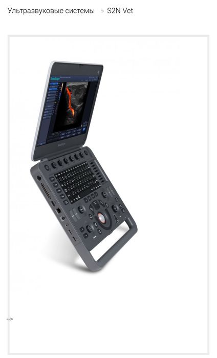 Продам узи аппарат sony scape