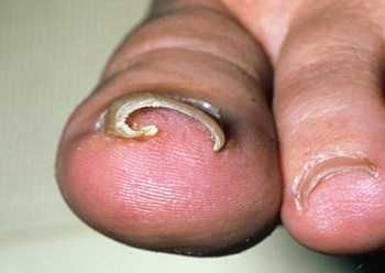 Ногти.  Тирнок. Tirnoq