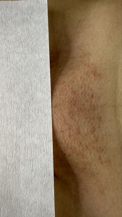 Обучаю депиляции