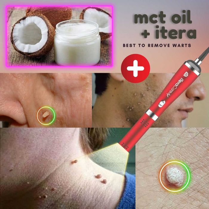 Dispozitiv Original iTeraCare Classic - Prife International