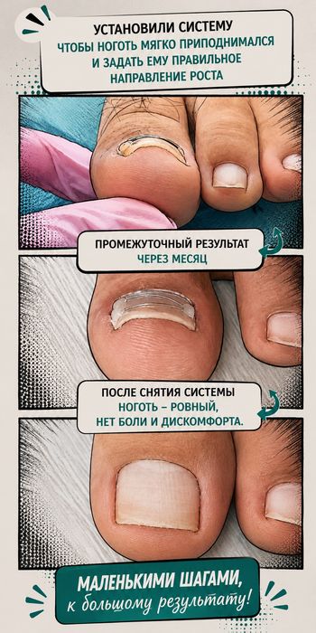 Педикюр, подолог