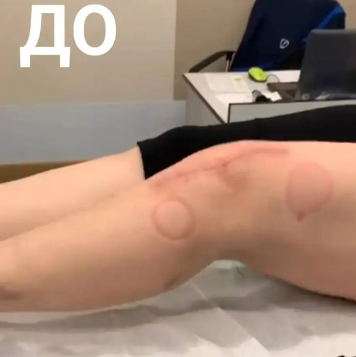 Немецкий Артромот аренда