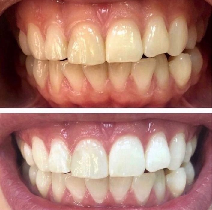 Продаеться бизнес отбеливание зубов