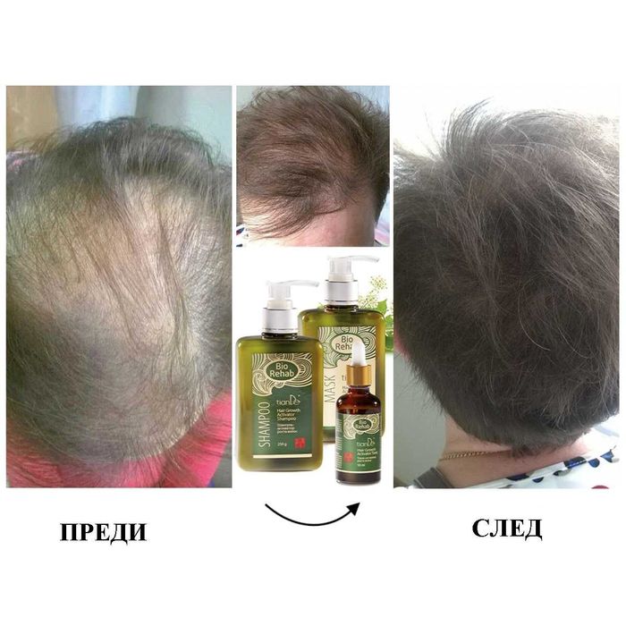 ТОП! Шампоан активатор на растежа„BIO REHAB“