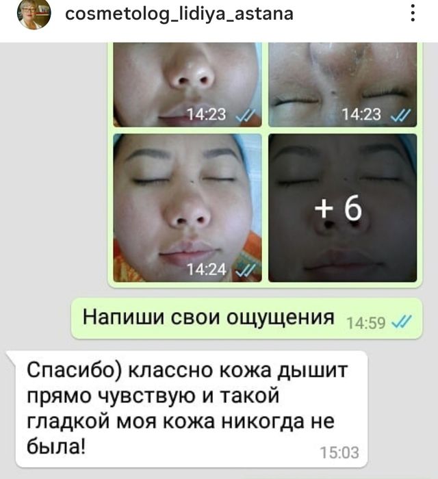 ЧИСТКА ЛИЦА от 7000.