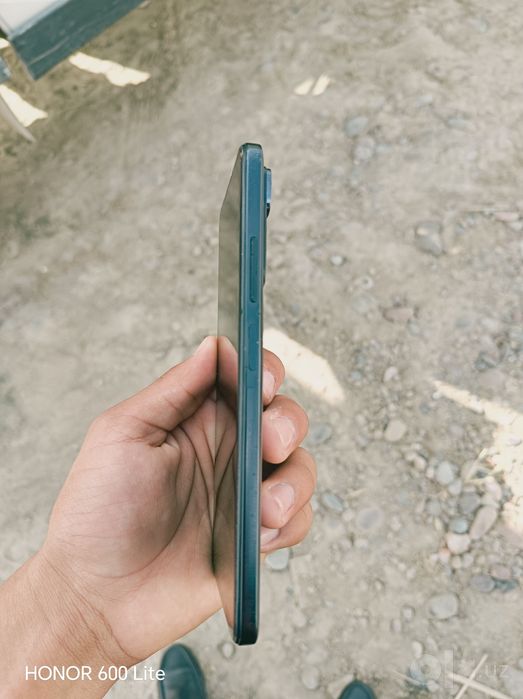 REDMI NOTE 11 holati yaxshi