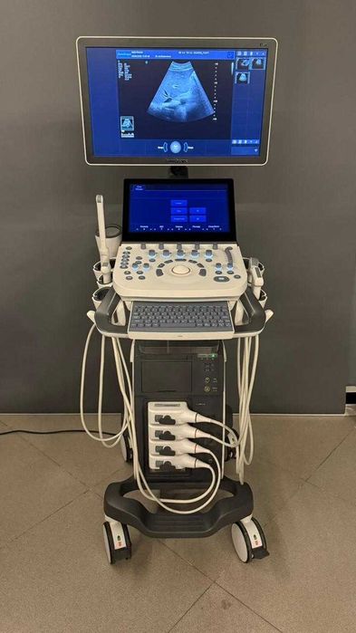 Стационарный УЗИ аппарат высокого класса SonoScape P20