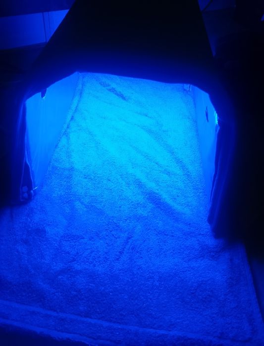 Фотолампа от желтуки