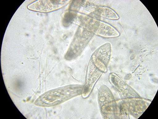 Инфузория туфелька фото под микроскопом Инфузория туфелька фото под микроскопом