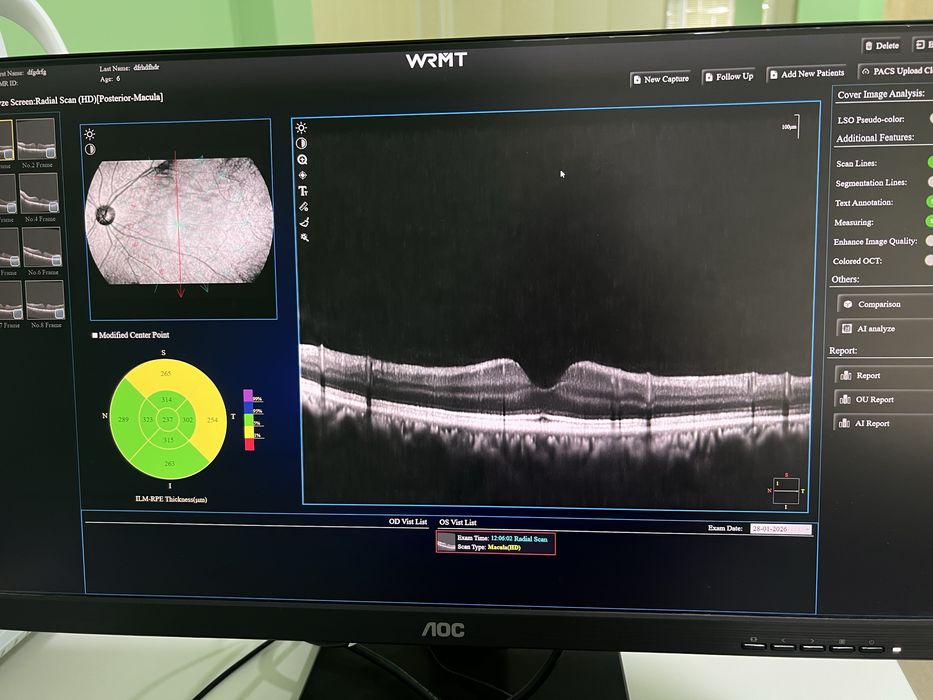 Офтальмологический OCT-аппарат WRMT C800