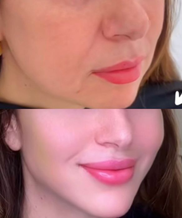 Косметолог эстет все уход и инъекционные процедуры