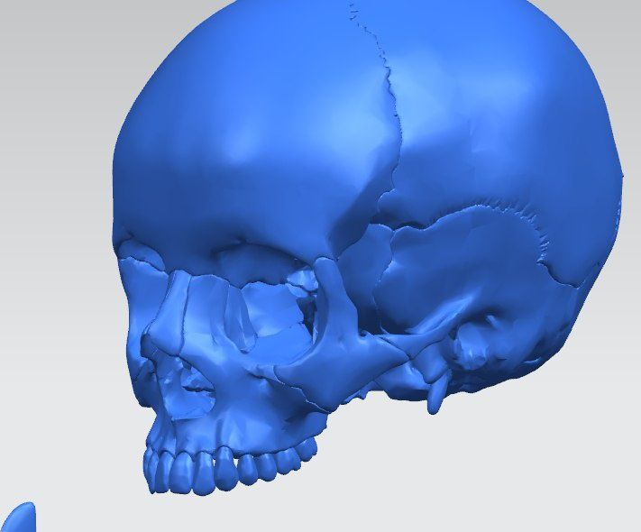 Bosh skeleti 3d printer da yasalgan