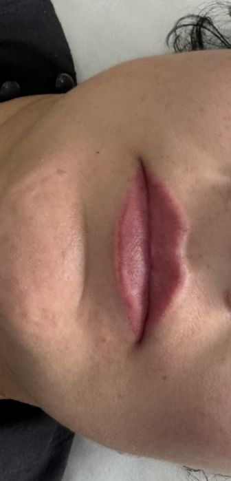 Эстетические процедуры для лица и губ.