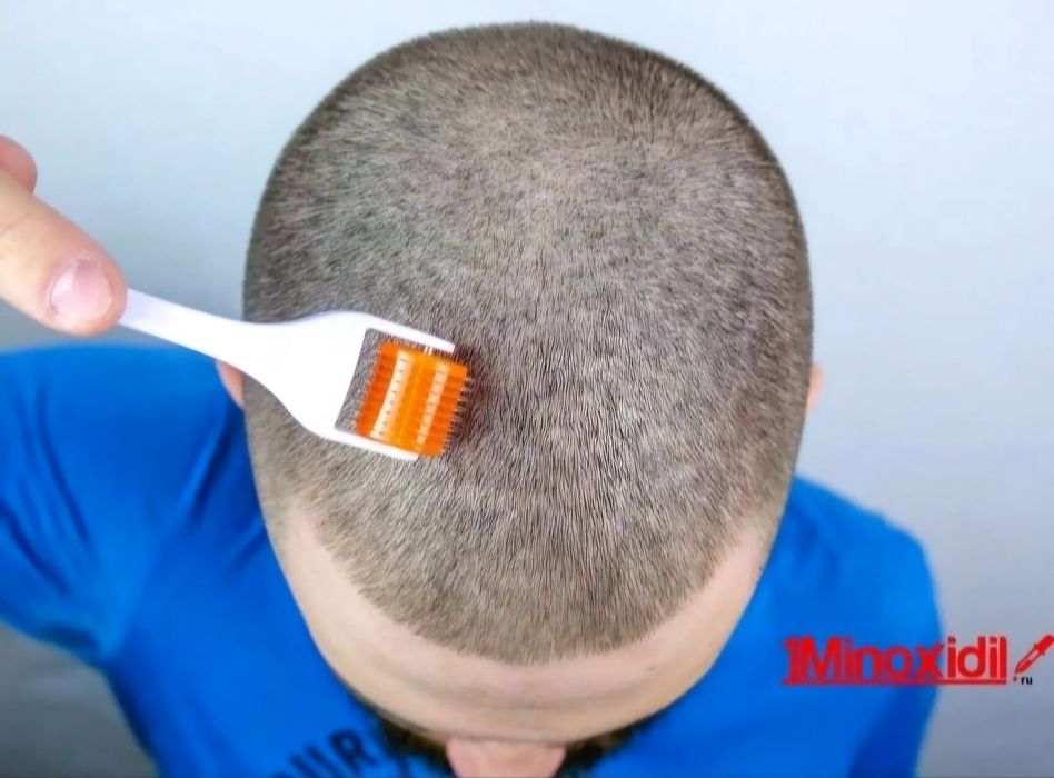 Лосьон для волос