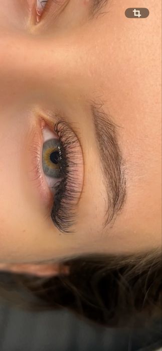 Extensii gene/Laminare