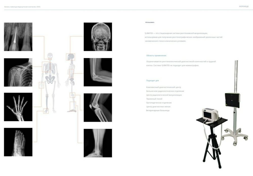 Портативный цифровой рентген аппарат. Mobile X-ray