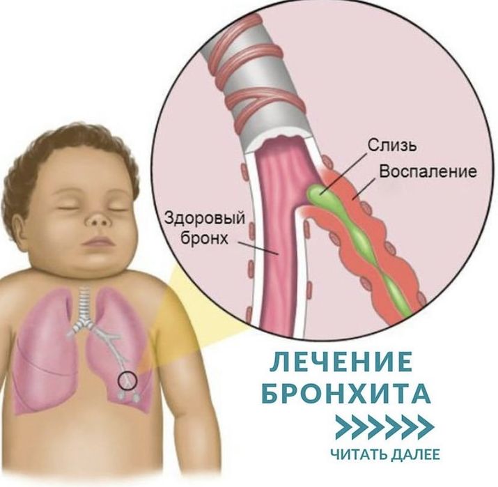 Отхаркивающее средство