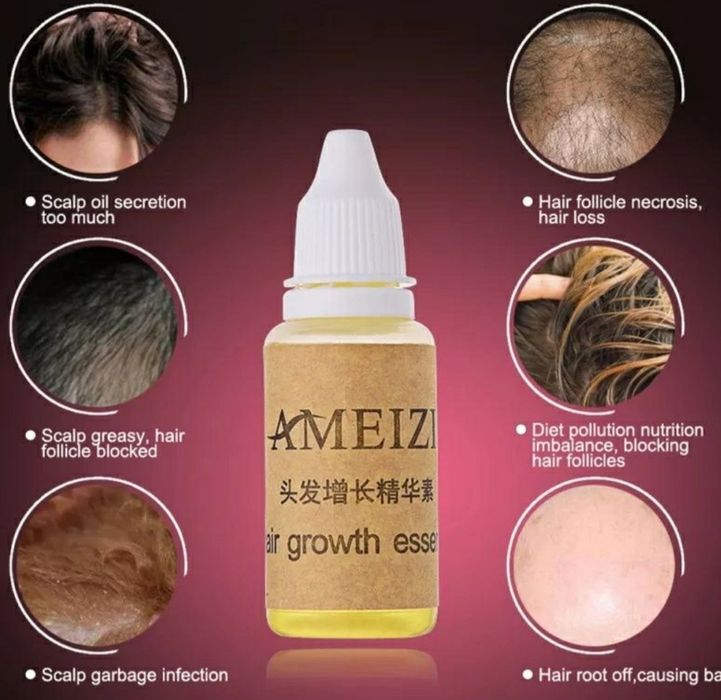 Ser ce se introduce in sampon spalare cadere par chelie cosmetice