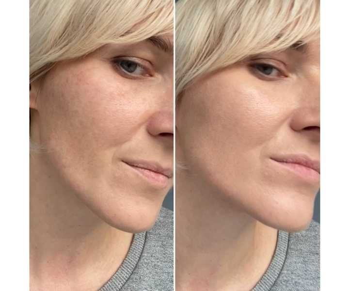 dr.hedison cushion за лице