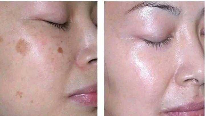 Крем за лице против бръчки и пигментни петна