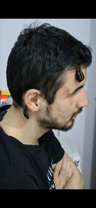 Xijoma v Zuluk muolaja xizmati