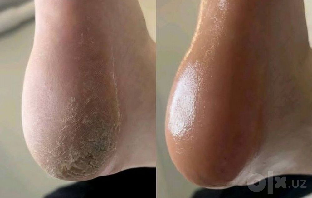 Педикюр , маникюр для пожилых: бережно , безопасно, без стресса