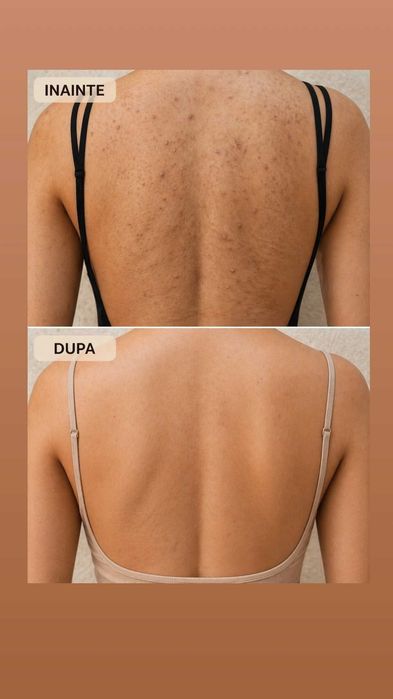 Pachet Hammam Marocan Ulei de  argan săpun Beldi kissa