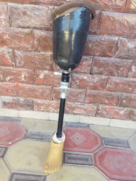 Protez chap oyoqniki