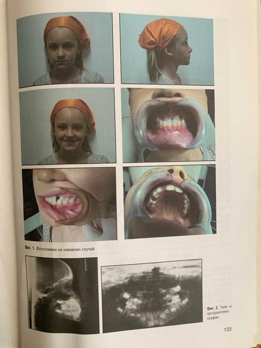 Ръководство по ортодонтия за студенти-проф.Вера Крумова