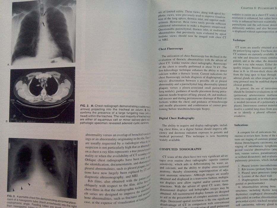 Carte Medicina  Compendiu boli pulmonare- pulmonary diseases