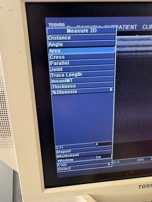 Ехограф Toshiba 15inch