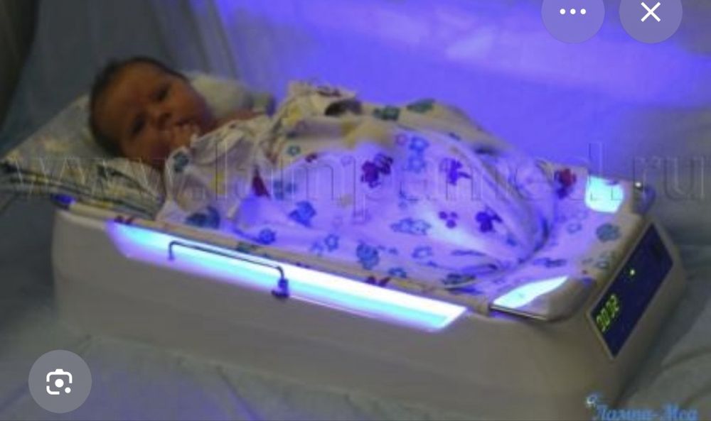 Лампа от желтушки