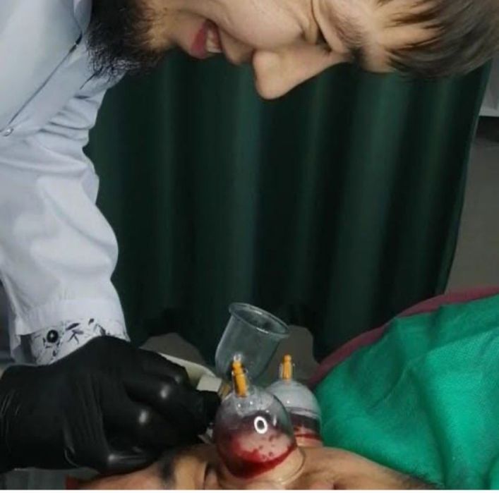 Хиджама на выезд