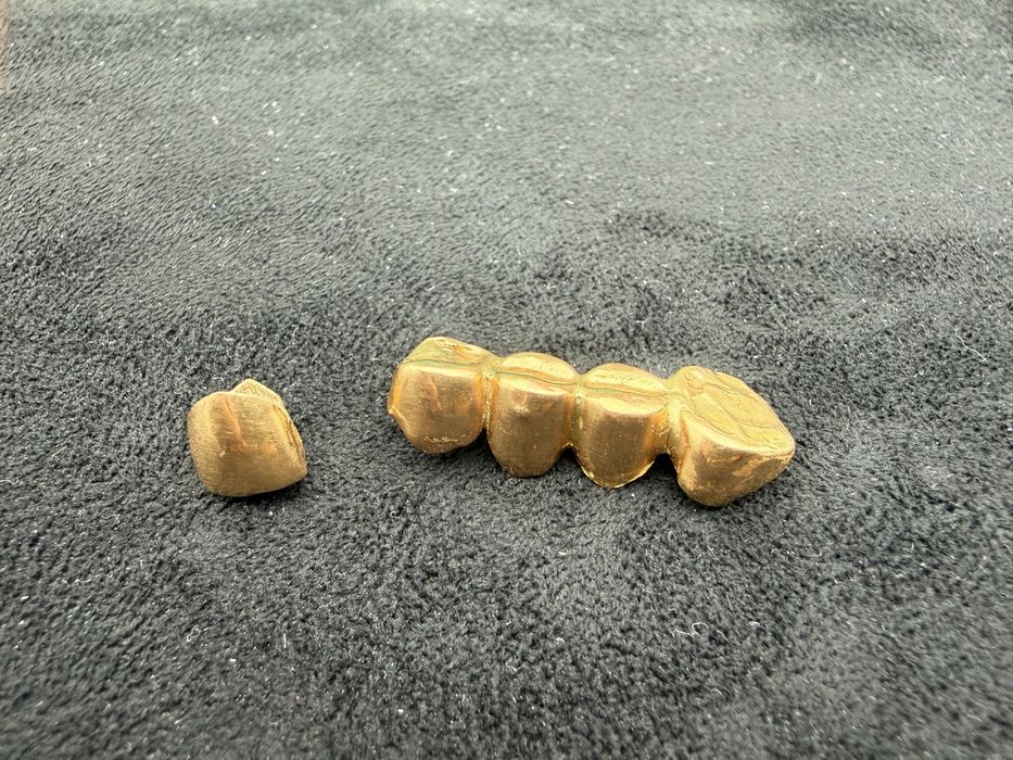 Золтые коронки 4.7 грамм 887 проба