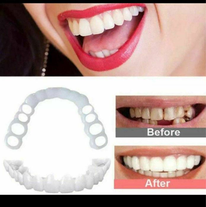 виниры для зубов белые съемные
