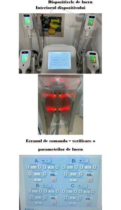 Vand Aparat Criolipoliza cu 5 manipuli. Perfect functional