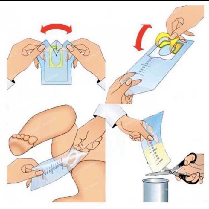 Мочеприемник детский универсальный, стерильный однократного применения